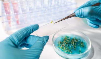 ajp linkedin web image 408x260 titlehere 8 v3